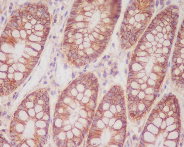 CD846